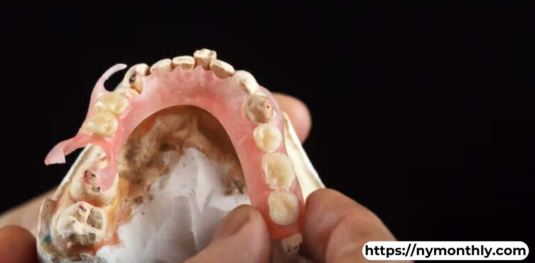 Partial Dentures for Back Teeth