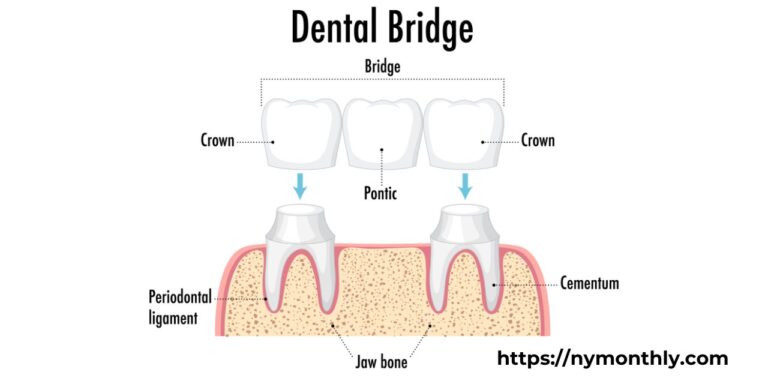 Single Front Tooth Crown Before and After